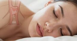 snoring causes and remedies