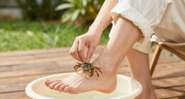A crab eating the dead skin from someone's foot