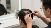 Comb-Over No More: Why Men's Hair Transplants Are Flourishing
