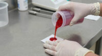 3 Best Bleeding Control Powders in 2026