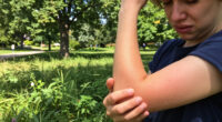 Rayden Vollrath Pokeweed Allergic Reaction
